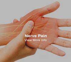 Graphic of Hand Showing Nerve Pain