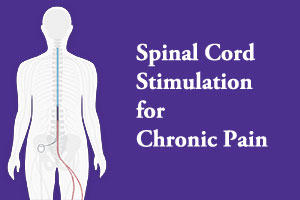 Spinal Cord Stimulation For Failed Back Surgery Patients: Louisiana Pain  Specialists: Pain Management